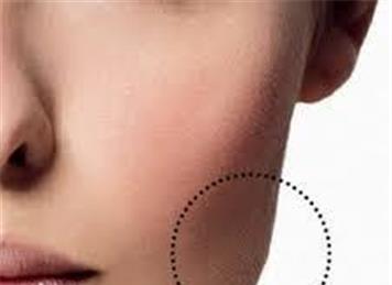 bukkal fat surgery in iran - Cosmetic surgery in Iran is a special offer at a cheap price for you